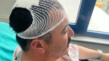 Yeniden Refah Partili Başkan Yardımcısı, belediye başkan yardımcısının kafasına şekerlikle vurdu