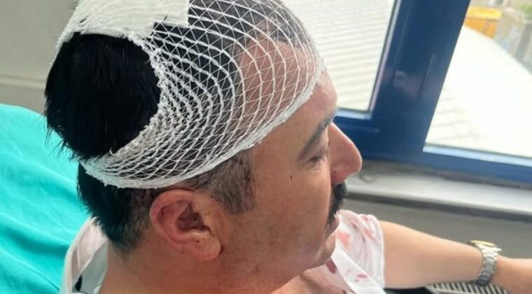 Belediye başkan yardımcısını şekerlikle yaralayan YRP’li başkan yardımcısı tutuklandı